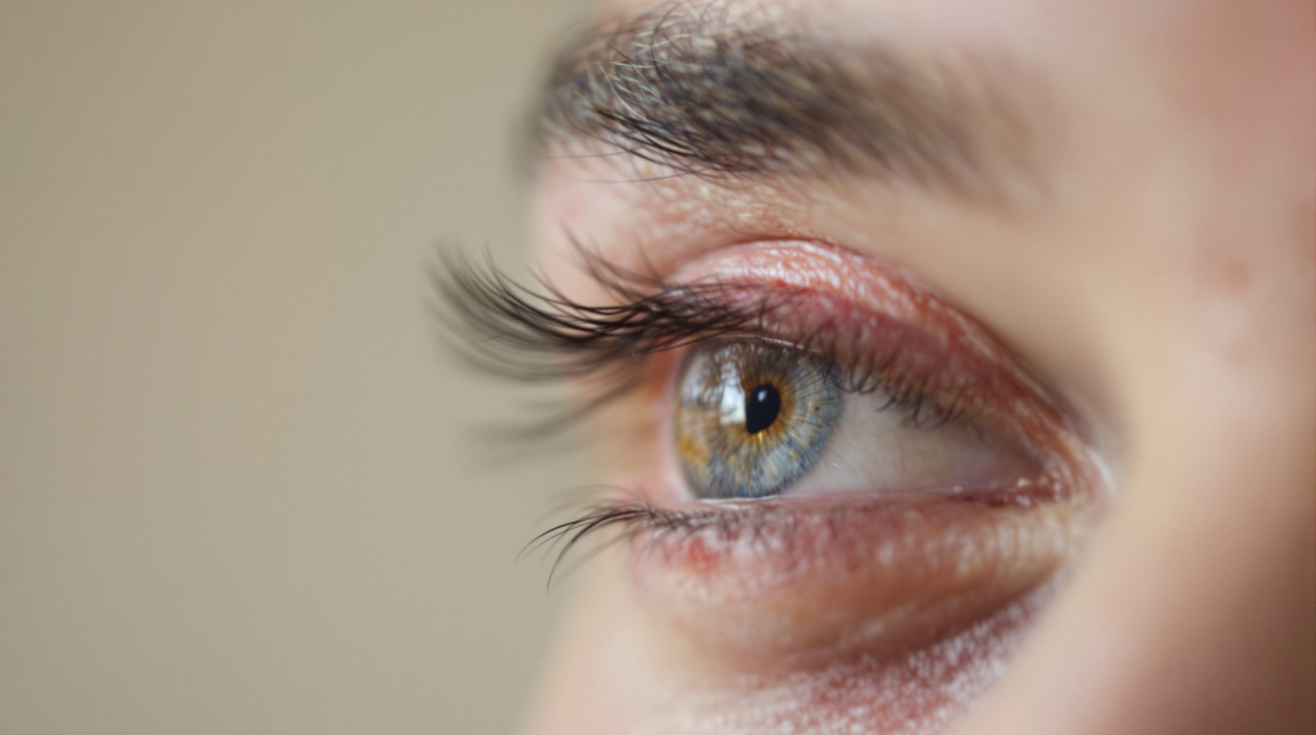 Allergie au maquillage des yeux : Symptômes, causes et solutions - Beaute Sublime