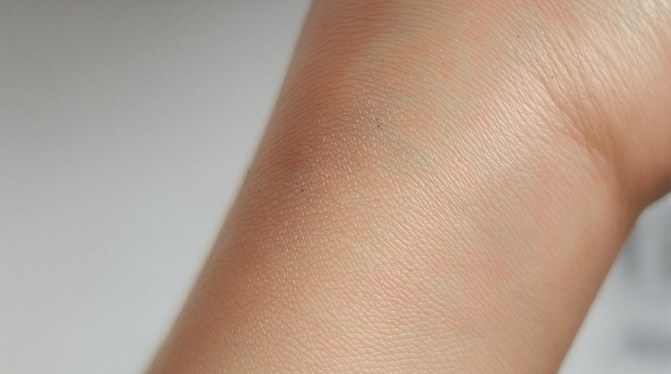 Comprendre et traiter la peau de fraise sur les bras - Beaute Sublime